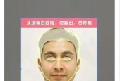手机拍照突然变黑的原因及解决方法？