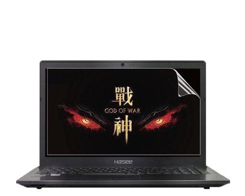 提升笔记本电脑运行速度的方法（简单实用的加速技巧）  第1张